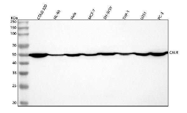  Western blot analysis of Calreticulin/CALR using anti-Calreticulin/CALR antibody (A00894-2)
