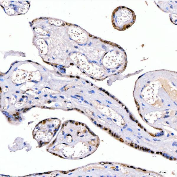a00896 1 lin28b primary antibodies ihc testing 2