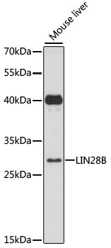 a00896 lin28b primary antiboties wb testing 1