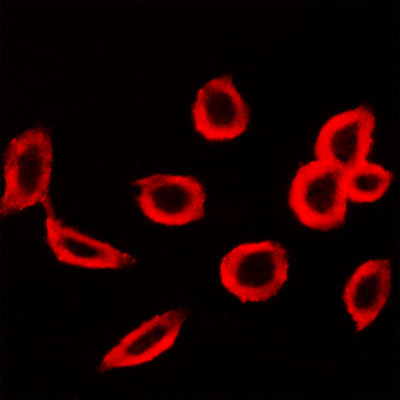 Immunocytochemistry stain of A549 cells using FSHR antibody (1:200)