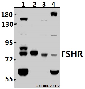 Western blot (WB) analysis of FSHR pAb at 1:500 dilution
Lane1:A2780 whole cell lysate(20ug)
Lane2:SK-OVCAR3 whole cell lysate(20ug)
Lane3:The Testis tissue lysate of Mouse(40ug)
Lane4:The Ovary tissue lysate of Rat(40ug)