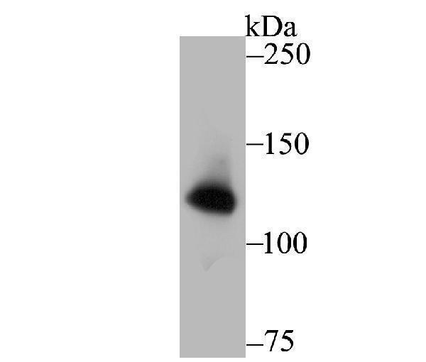 Western blot analysis of hUPF1 on PC-3M cell lysate using anti-hUPF1 antibody at 1/1,000 dilution