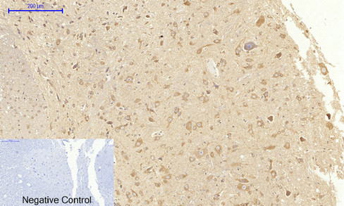 a00901 1 kdr primary antibodies ihc testing 5