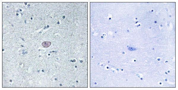 a00901 1 kdr primary antibodies ihc testing 6