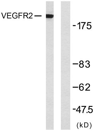 Western blot analysis of lysates from SK-OV3 cells, using VEGFR2 Antibody