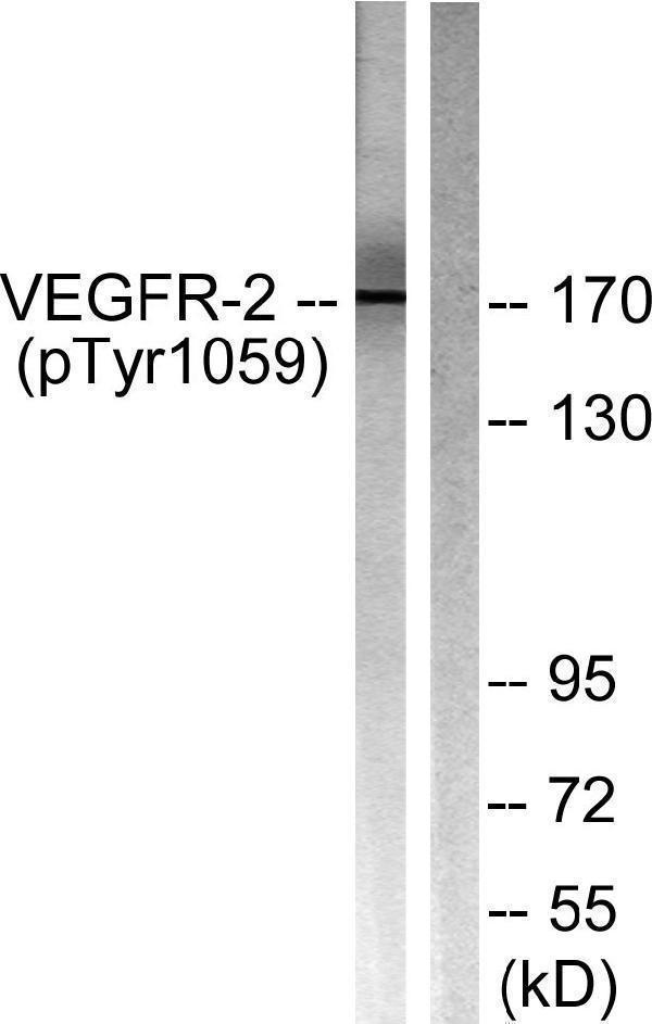 Western blot analysis of lysates from HepG2 cells treated with Na3VO4 0