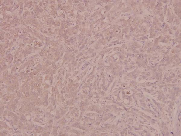 a00901y1175 kdr primary antiboties ihc testing 2