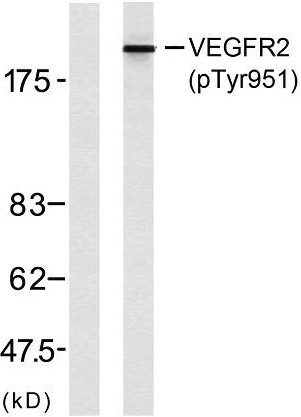 Western blot analysis of lysates from SK-OV3 cells, using VEGFR2 (Phospho-Tyr951) Antibody