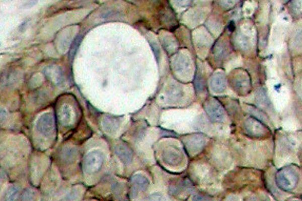 a00901y951 kdr primary antiboties ihc testing 2