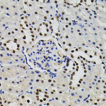 a00903 gtf2i primary antiboties ihc testing 3