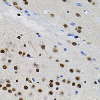 a00903 gtf2i primary antiboties ihc testing 4