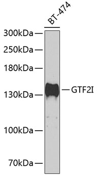 a00903 gtf2i primary antiboties wb testing 1