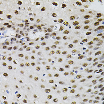 a00903 gtf2i primary antiboties wb testing 2