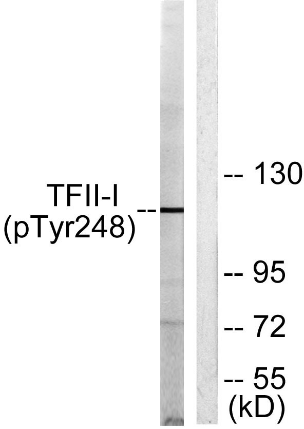 Western blot analysis of lysates from LOVO cells, using TFII-I (Phospho-Tyr248) Antibody