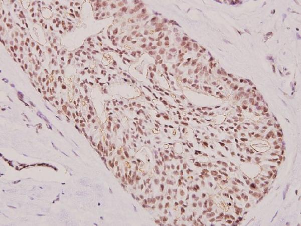 a00904 1 atf3 primary antiboties ihc testing 2