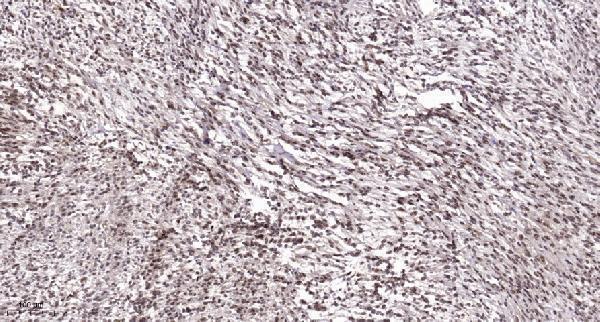 a00904 2 atf3 primary antibodies ihc testing 1