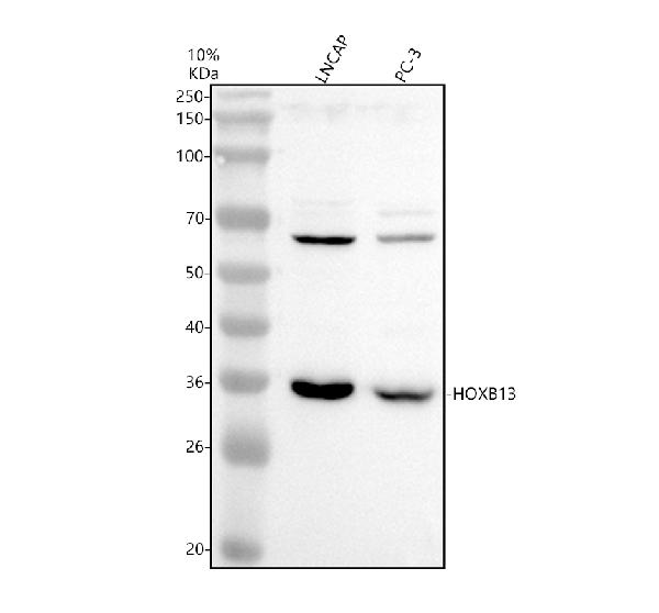 Western blot analysis of HOXB13 using anti-HOXB13 antibody (A00908-3)