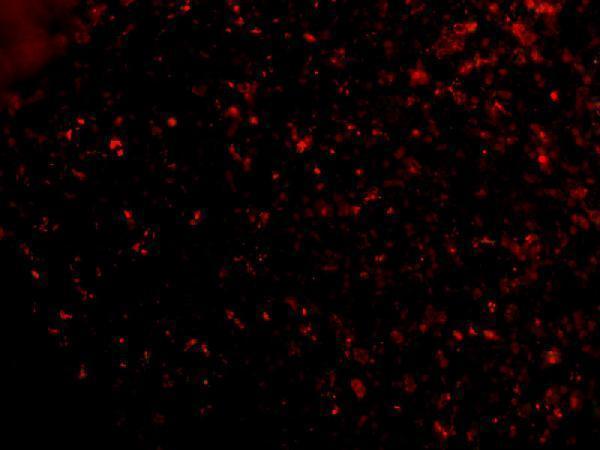 Immunofluorescence of ORAI1 in Human Spleen cells with ORAI1 antibody at 20 μg/mL