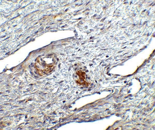 Immunohistochemistry of ORAI1 in human ovary tissue with ORAI1 antibody at 2
