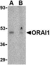 Western blot analysis of ORAI1 in human ovary tissue lysate with ORAI1 antibody at 1 μg/mL in the (A) absence or (B) presence of blocking peptide