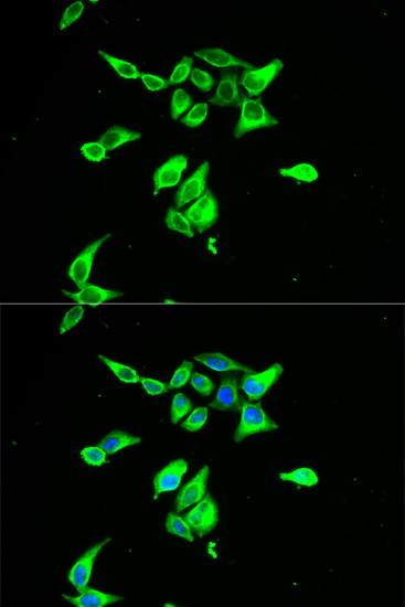 Immunofluorescence analysis of A-549 cells using CD55 Rabbit pAb1  at dilution of 1:150 