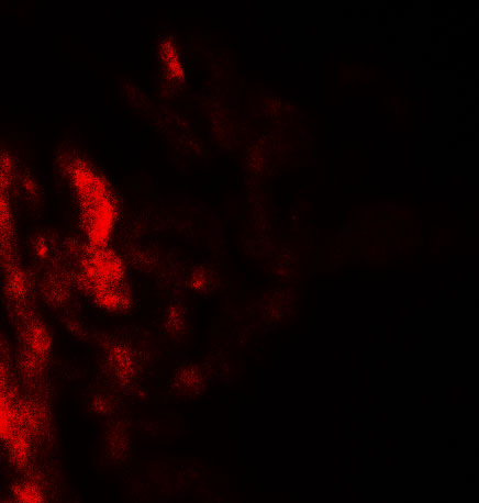 Immunofluorescence of DAF in human lung tissue with DAF antibody at 20 μg/ml