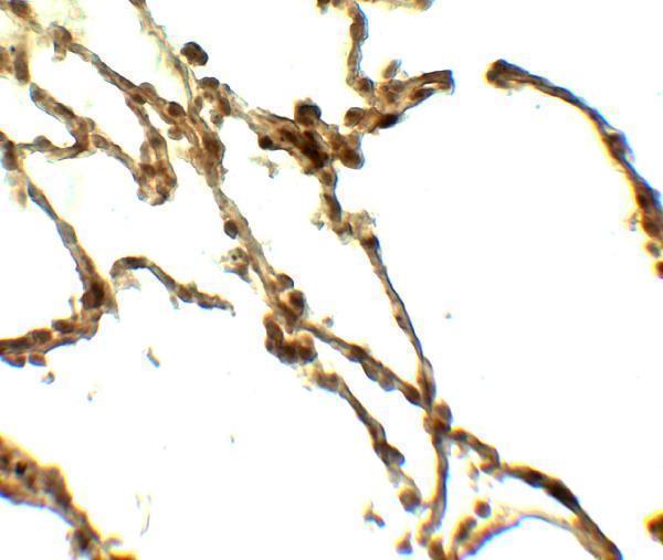 Immunohistochemistry of DAF in human lung tissue with DAF antibody at 5 μg/ml
