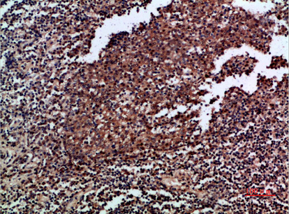 Immunohistochemical analysis of paraffin-embedded human-tonsil, antibody was diluted at 1:200