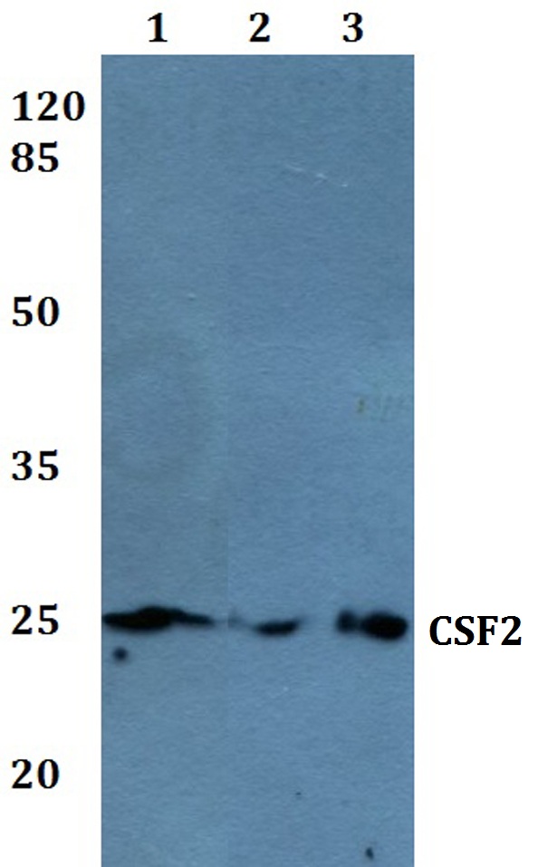 Western blot (WB) analysis of CSF2 polyclonal antibody at 1:500 dilution
Lane1:THP-1 whole cell lysate
Lane2:Raw264