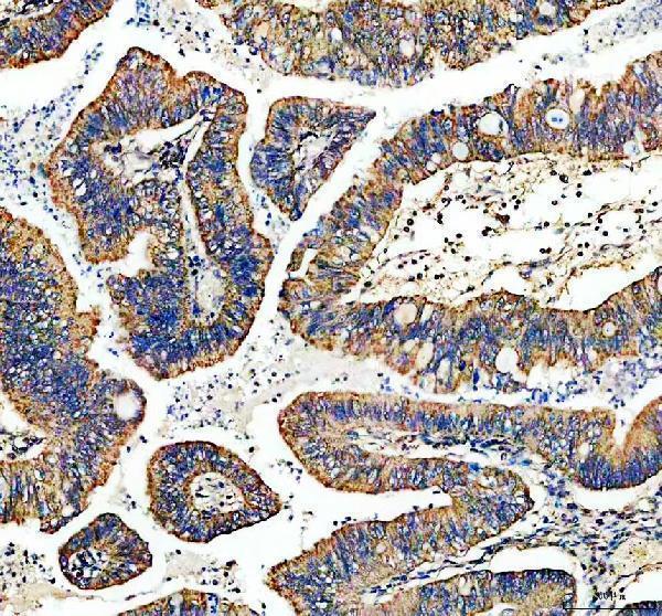 IHC analysis of TYRO3 using anti-TYRO3 antibody (A00913-2)