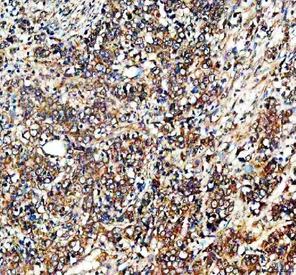 IHC analysis of TYRO3 using anti-TYRO3 antibody (A00913-2)