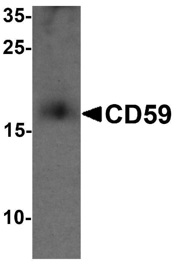 a00914 1 cd59 primary antibodies wb testing 1