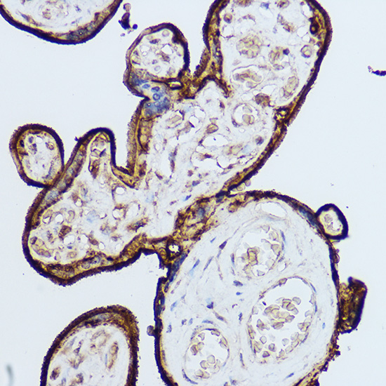 a00914 2 cd59 primary antiboties ihc testing 3