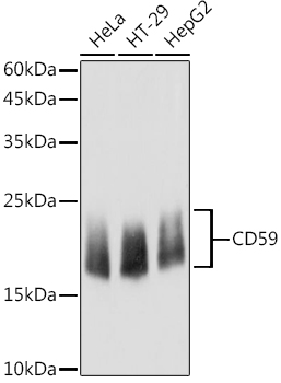 a00914 2 cd59 primary antiboties wb testing 1