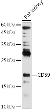 a00914 2 cd59 primary antiboties wb testing 2