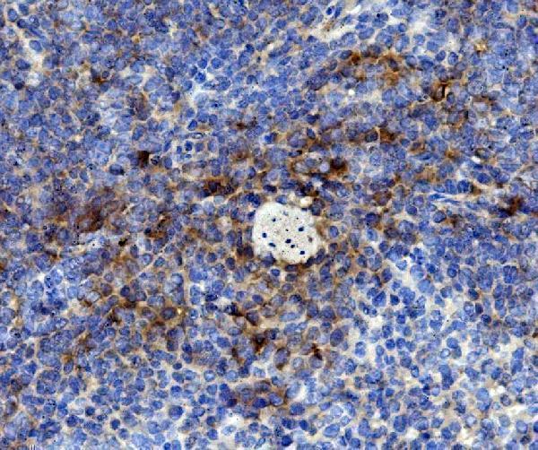 a00914 3 cd59 primary antibodies ihc testing 1