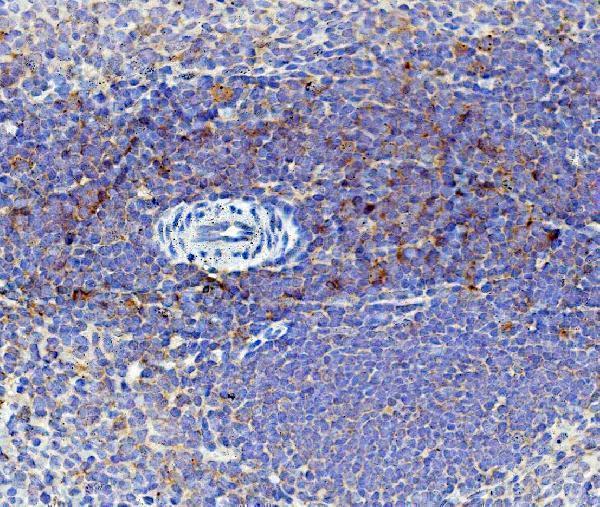 a00914 3 cd59 primary antibodies ihc testing 2