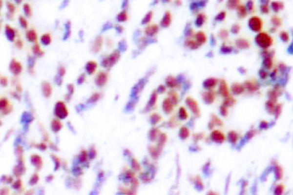 a00916s112 atf2 primary antiboties ihc testing 2