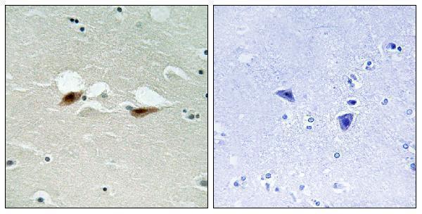 a00916s472 atf2 primary antibodies ihc testing 2