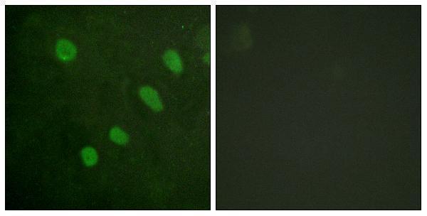a00916s480 atf2 primary antibodies if testing 4