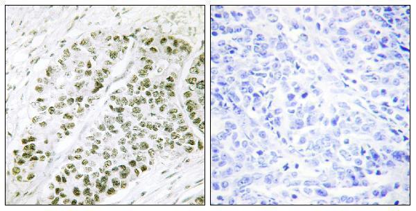 a00916s480 atf2 primary antibodies ihc testing 3