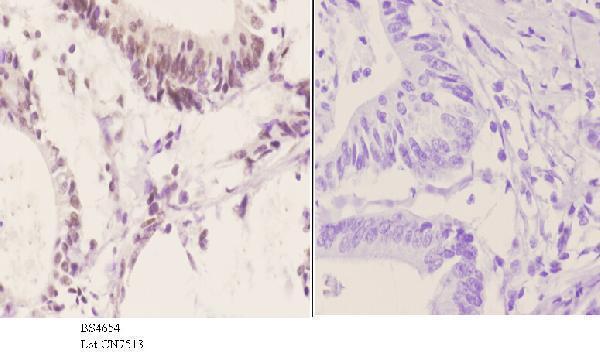 a00916s498 atf2 primary antiboties ihc testing 3