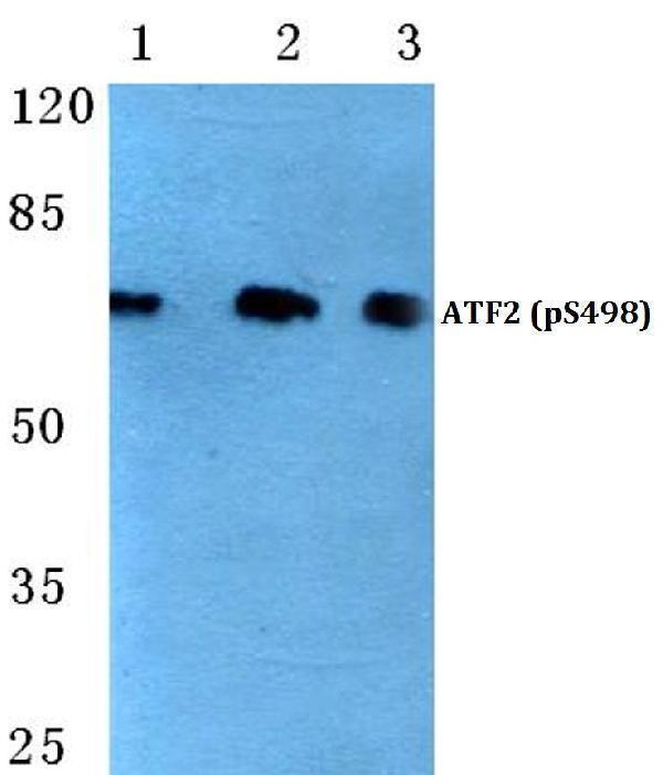 a00916s498 atf2 primary antiboties wb testing 1