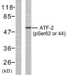a00916s62 1 atf2 primary antibodies wb testing 3