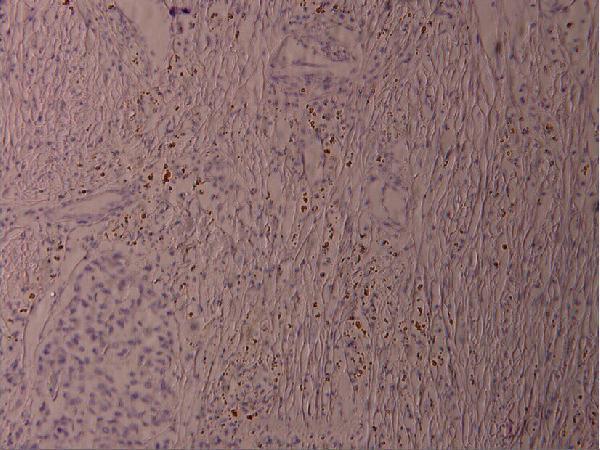 a00916s62 atf2 primary antiboties ihc testing 2