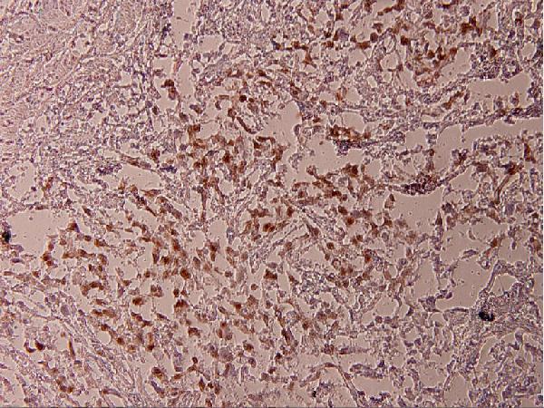 a00916t69 atf2 primary antiboties ihc testing 2