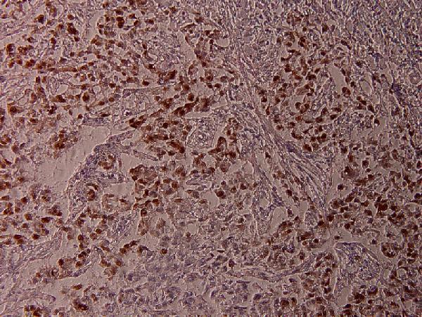 a00916t71 atf2 primary antiboties ihc testing 2