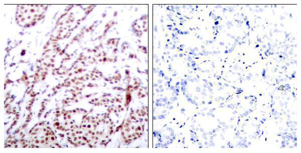 a00916t73 1 atf2 primary antibodies ihc testing 1