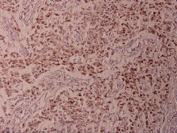 a00916t73 atf2 primary antiboties ihc testing 2