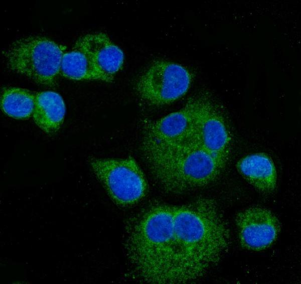 a00917 3 cpt1a primary antibodies if testing 6